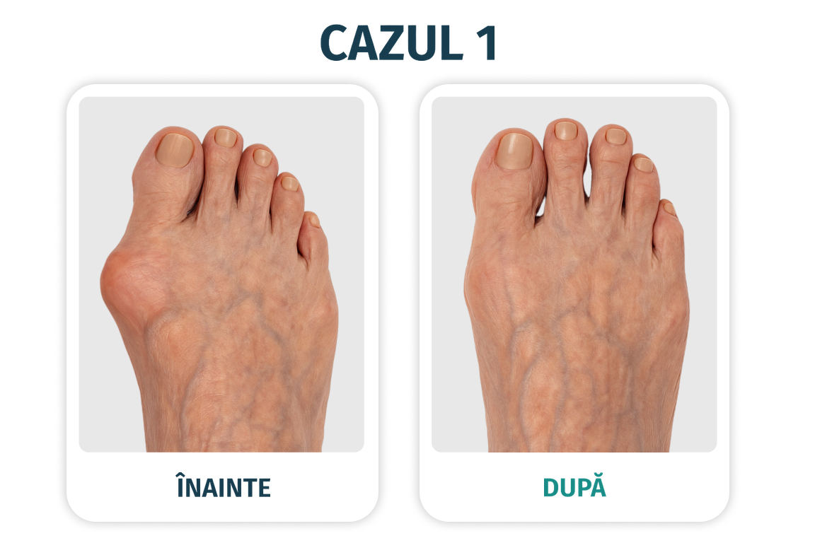Imagine comparativă pentru cazul 1
